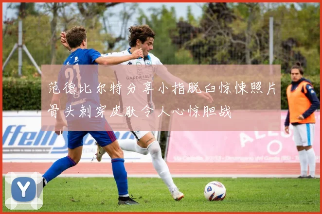 范德比尔特分享小指脱臼惊悚照片骨头刺穿皮肤令人心惊胆战